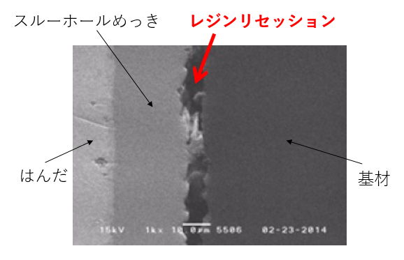 レジンリセッションの状況